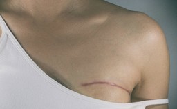 seno-tumore.jpg - {seno-tumore.jpg} - [120022]