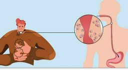 MalattieEsofago.jpg - {MalattieEsofago.jpg} - [143200]