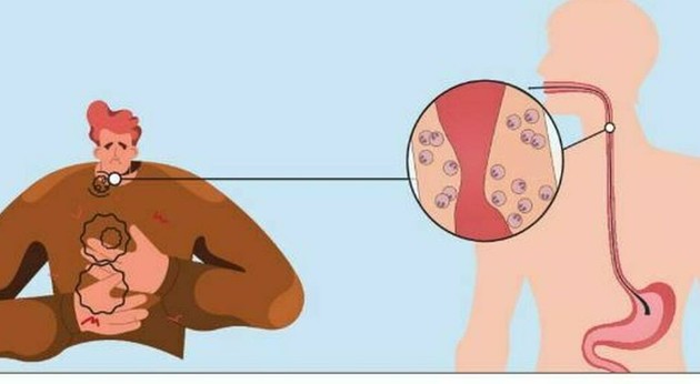 MalattieEsofago.jpg - {MalattieEsofago.jpg} - [143200]