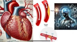 Intelligenza arficiale per le coronarie.jpg - {Intelligenza arficiale per le coronarie.jpg} - [15048]